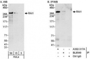 NBP1-28745 - RAI1
