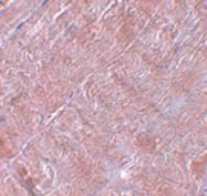 NBP1-77372 - RANBP10