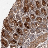 NBP1-91028 - RANBP17