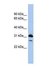 NBP1-54871 - RAP1B