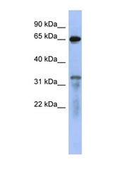 NBP1-53072 - RAP1GAP