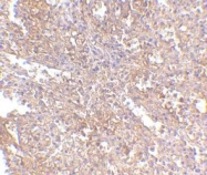 NBP1-76828 - UIMC1 / RAP80