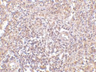NBP1-76829 - UIMC1 / RAP80