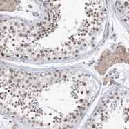 NBP1-87156 - UIMC1 / RAP80
