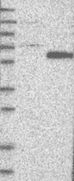 NBP1-81776 - RAR-beta / RARB