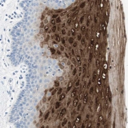 NBP1-83214 - RARRES3