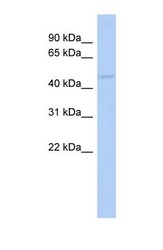 NBP1-58874 - RASGEF1C
