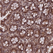 NBP1-85727 - RASGRF1