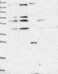 NBP1-85727 - RASGRF1