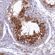 NBP1-92317 - RASGRP4