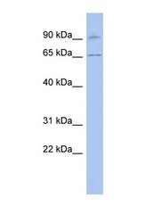 NBP1-58871 - RASGRP2