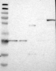 NBP1-86661 - RASGRP2