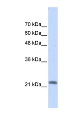 NBP1-58920 - RASL10A