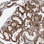 NBP1-80857 - DNAJC27 / RBJ