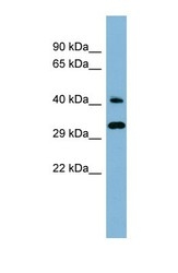 NBP1-58940 - DNAJC27 / RBJ