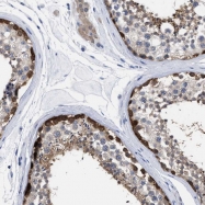 NBP1-84116 - Ribokinase / RBKS