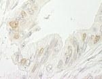 NB100-55265 - RBM10