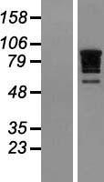 NBL1-15194 - RBM10 Lysate
