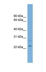 NBP1-57083 - RBM11