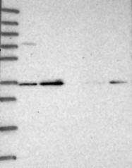 NBP1-92320 - RBM11