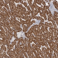 NBP1-85981 - RBM12B