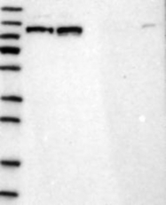 NBP1-82465 - RBM15