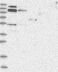 NBP1-81650 - RBM15B