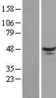 NBL1-15198 - RBM17 Lysate
