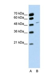 NBP1-57327 - RBM22