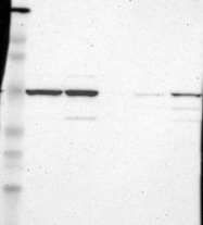 NBP1-85379 - RBM22