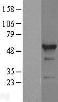 NBL1-15200 - RBM22 Lysate