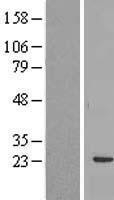 NBL1-15202 - RBM24 Lysate