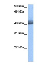 NBP1-57385 - RBM40 / RNPC3