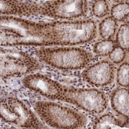 NBP1-82770 - RBM42