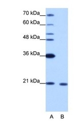 NBP1-57274 - RBM8A / RBM8