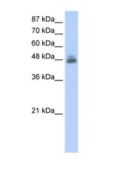 NBP1-58231 - RBMS1