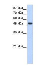 NBP1-58232 - RBMS1