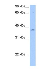 NBP1-57363 - RBMY1A1 / RBMY1C