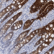 NBP1-85464 - Retinol-binding protein 2 / RBP2