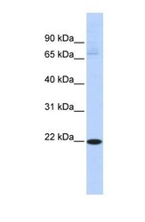 NBP1-57399 - RBPMS2