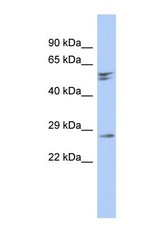 NBP1-55461 - RD3