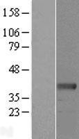NBL1-15254 - RDH10 Lysate