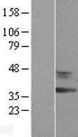 NBL1-15256 - RDH12 Lysate