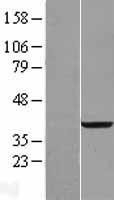 NBL1-15258 - RDH14 Lysate