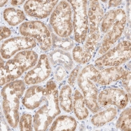 NBP1-82708 - RDM1 / RAD52B