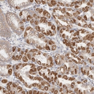NBP1-82709 - RDM1 / RAD52B