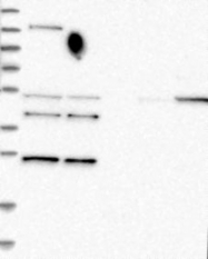 NBP1-82709 - RDM1 / RAD52B