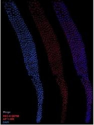 29470002 - REC8