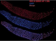 29470002 - REC8