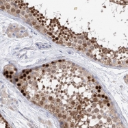 NBP1-87145 - REC8